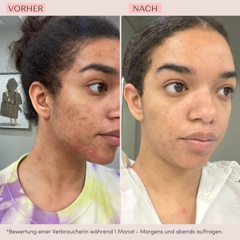Glyconight 10% Night Mask Peel Yonka 50ml - Dreifach wirksam mit 10% reinem Glykol | Anti-Aging, Neue-Haut-Effekt, Ausstrahlung - Dermatologisch nachgewiesene Ergebnisse! 98% natürlichen Ursprungs
