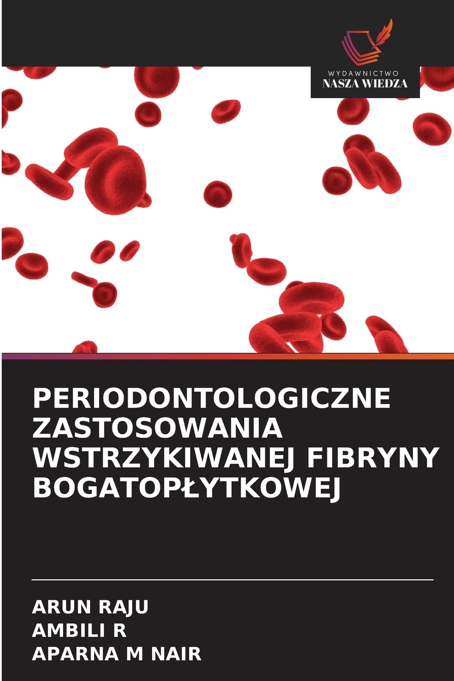 Periodontologiczne Zastosowania Wstrzykiwanej Fibryny Bogatoplytkowej