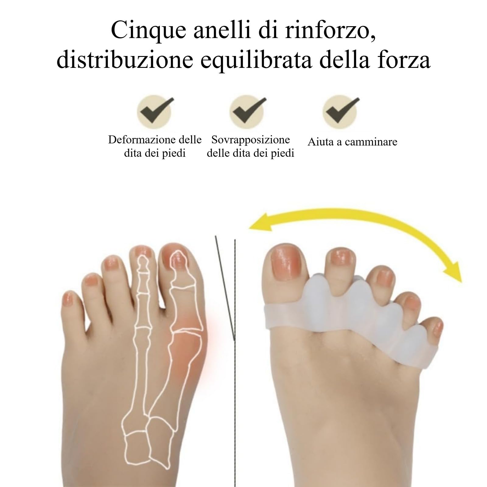 Distanfix Alluce Valgo, Morbido supporto in silicone per uomo e donna, comfort indicato per l'alluce valgo (Beige)