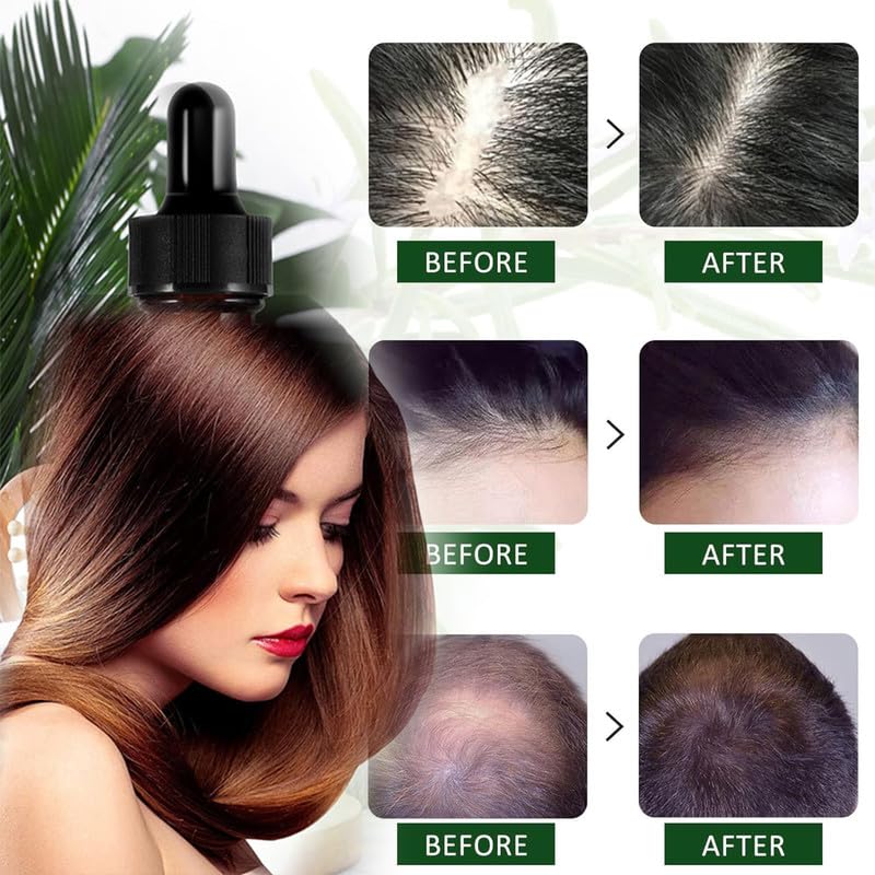 Miniatura 6 de Aceite de Romero para, Aceite de Romero para el Crecimiento Del Cabello, 1 Masajeador, Aceite de Ricino para Cejas y Pestañas y Cuidado de la Piel