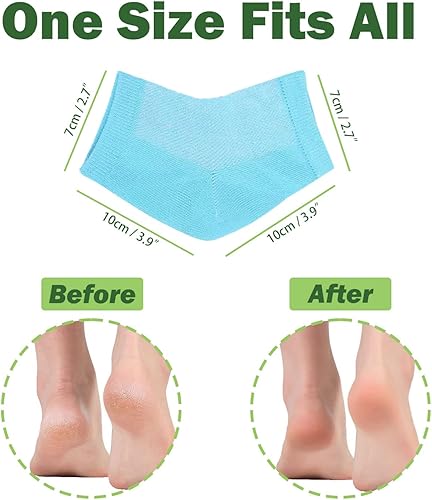 Miniatura 4 de 2 pares de calcetines de gel hidratante, tratamiento de talón seco para pies ásperos, reparación de pies agrietados, calcetines de aloe de spa para