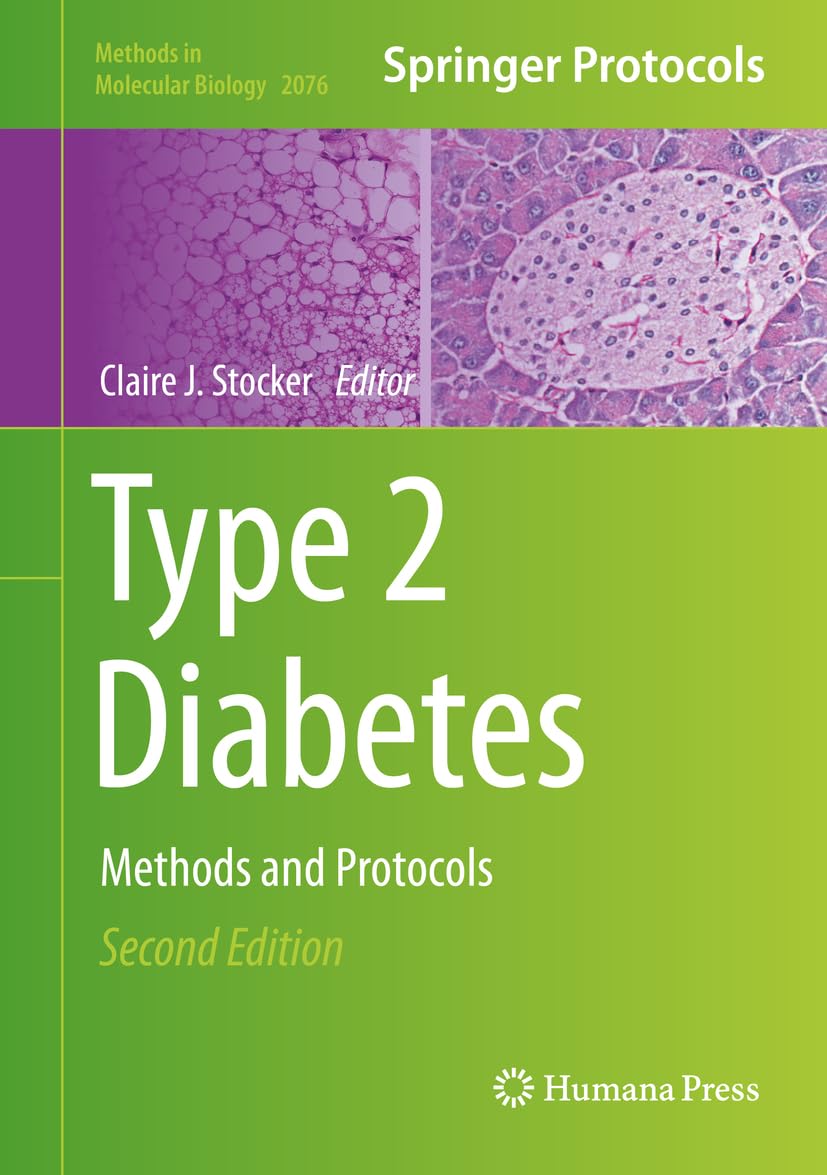 Type 2 Diabetes: Methods and Protocols (Methods in Molecular Biology Book 2076) (English Edition)