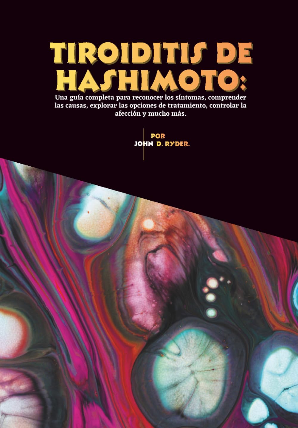 Tiroiditis de Hashimoto: Una guía completa para reconocer los síntomas, comprender las causas, explorar las opciones de tratamiento, controlar la afección y mucho más.