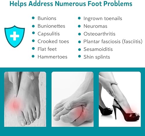 Miniatura 2 de KIYOKI 2 pares de separadores de dedos, espaciadores de dedos para juanetes para mujereshombres, alineación de pies, firme para usuarios avanzados,