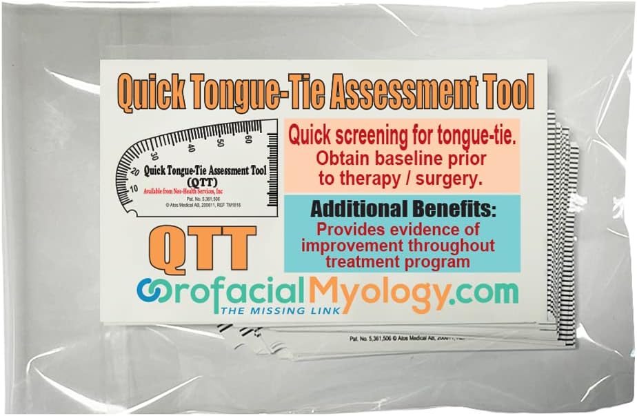 Quick Tongue-Tie Assessment