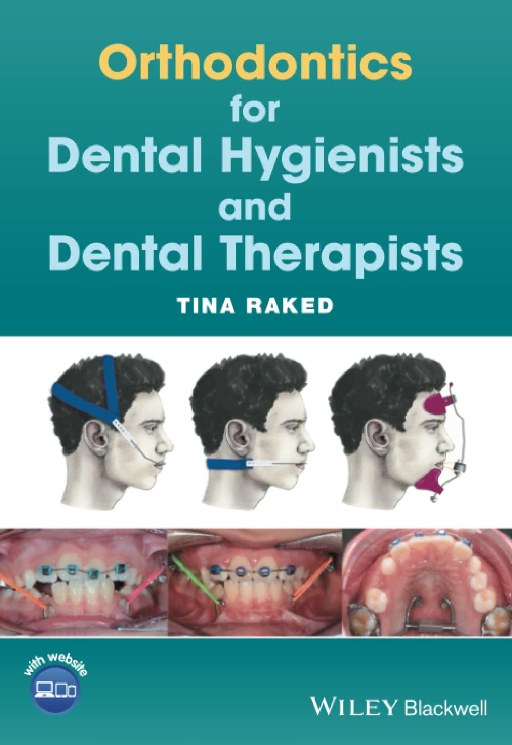 Orthodontics for Dental Hygienists and Dental Therapists