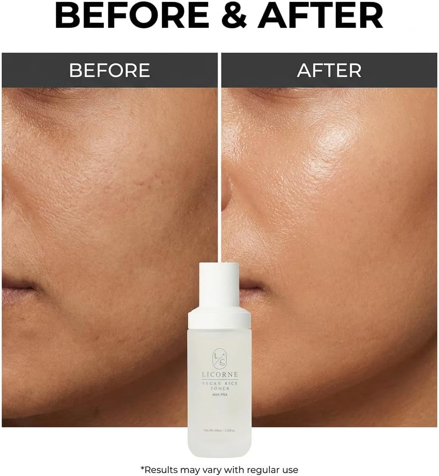 LICORNE Vegan Rice Toner, Daily Exfoliating Face Toner for Glass Skin, AHA/PHA & Rice Water for Uneven Texture & Pores, Gentle Resurfacing & Hydrating Essence Water, 3.38 fl oz - Image 8