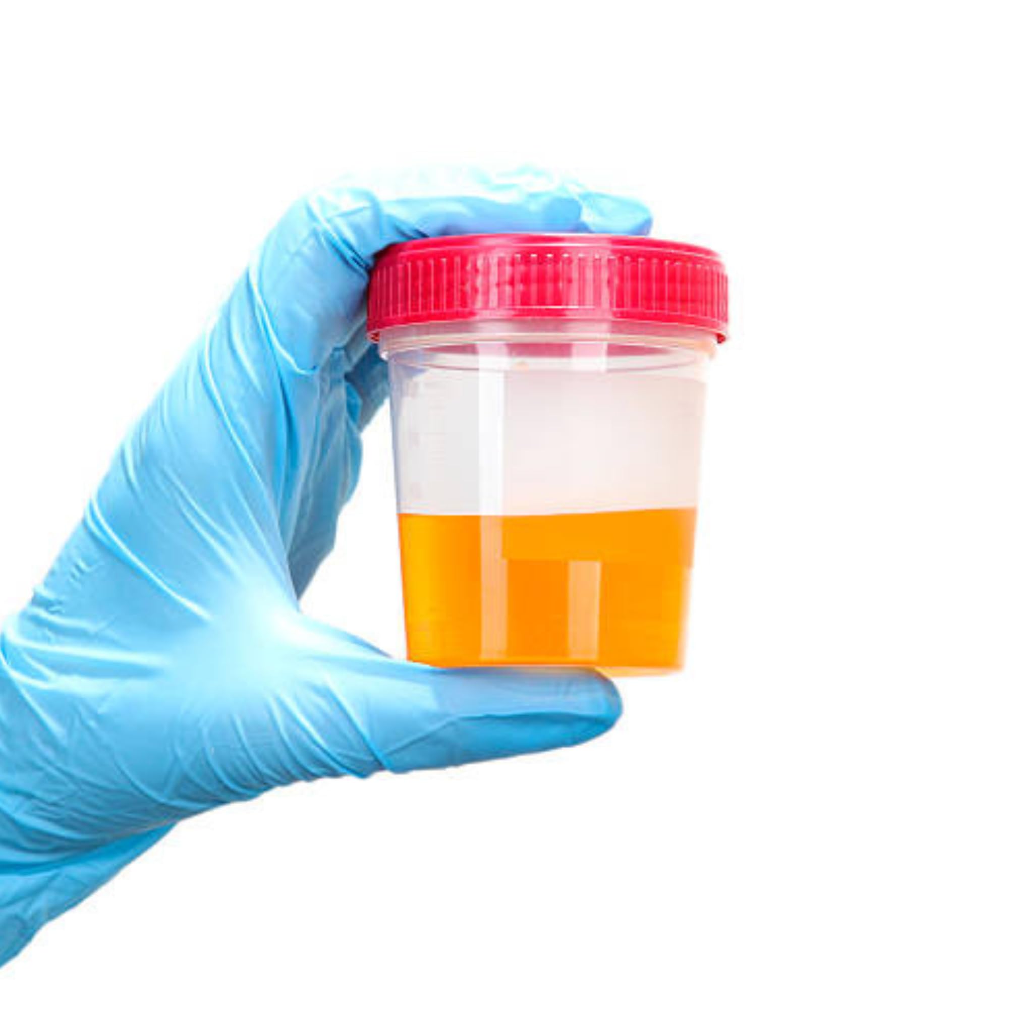 Topolenashop 4 Contenitori Urine Sterili 120 ml con Tappo a Vite ed Etichetta – Vasetti Monouso per Analisi Urine, Urinocoltura ed Esami di Laboratorio, Made in Italy