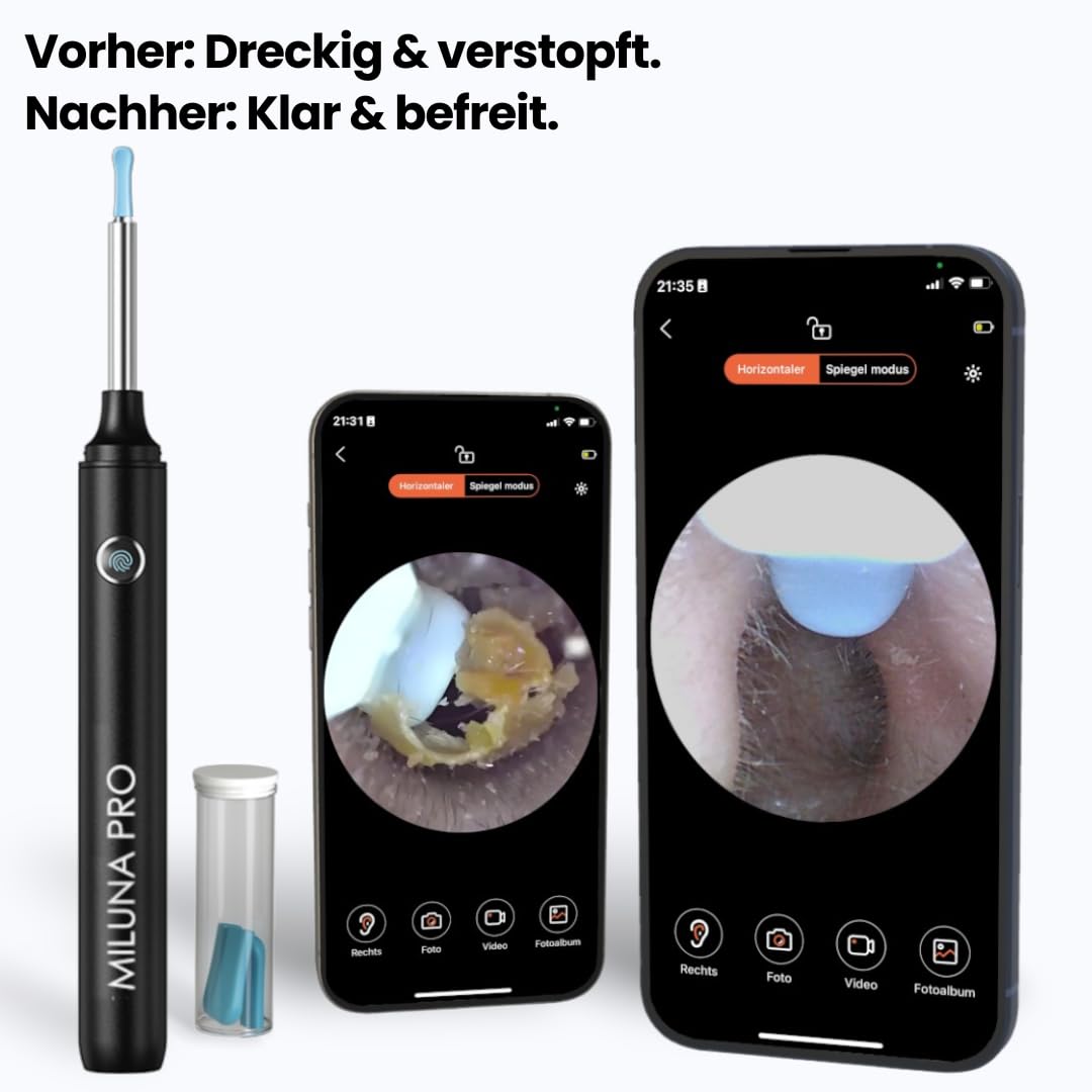 miluna pro - intelligenter ohrenreiniger mit hd-kamera Intelligenter Ohrenreiniger mit HD-Kamera – Effizienter Ohrenschmalz Entferner und Ohrenschmalz-Sauger für eine gründliche Ohrenreinigung