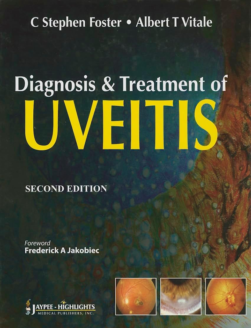 Diagnosis and Treatment of Uveitis