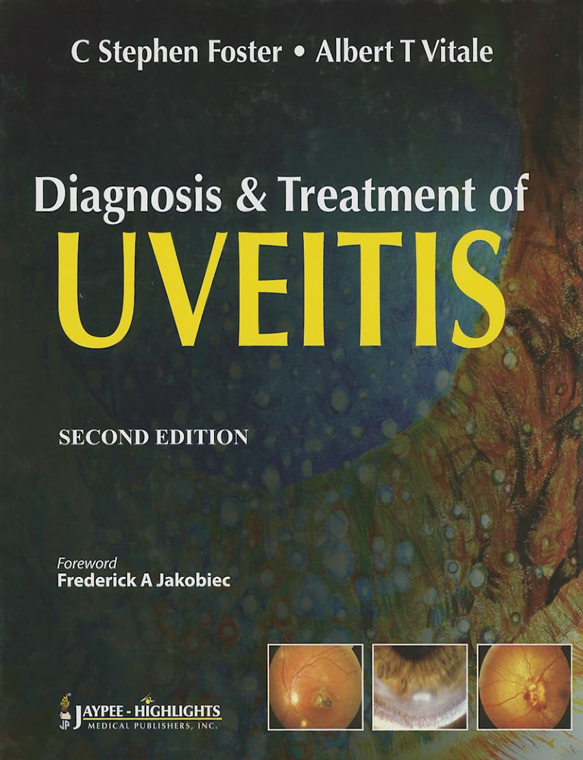 Diagnosis and Treatment of Uveitis