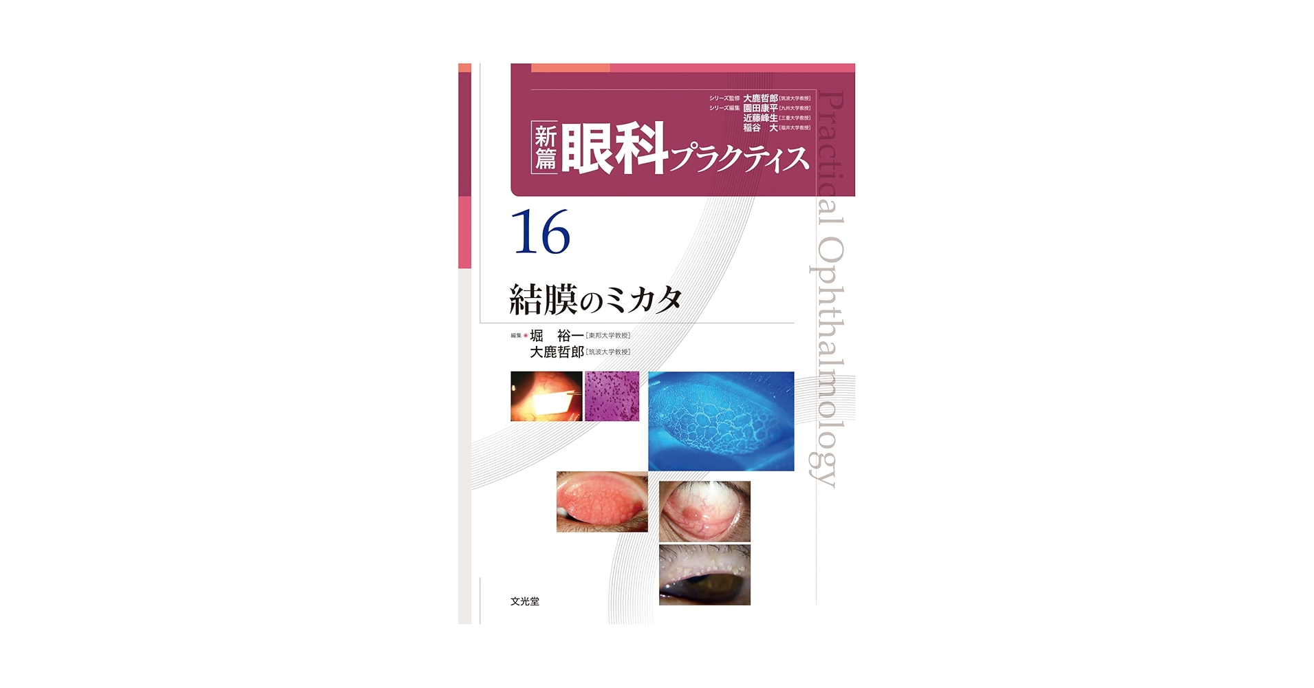 結膜のミカタ (新篇眼科プラクティス 16) 結膜のミカタ (新篇眼科プラクティス 16) | 堀 裕一, 大鹿哲郎