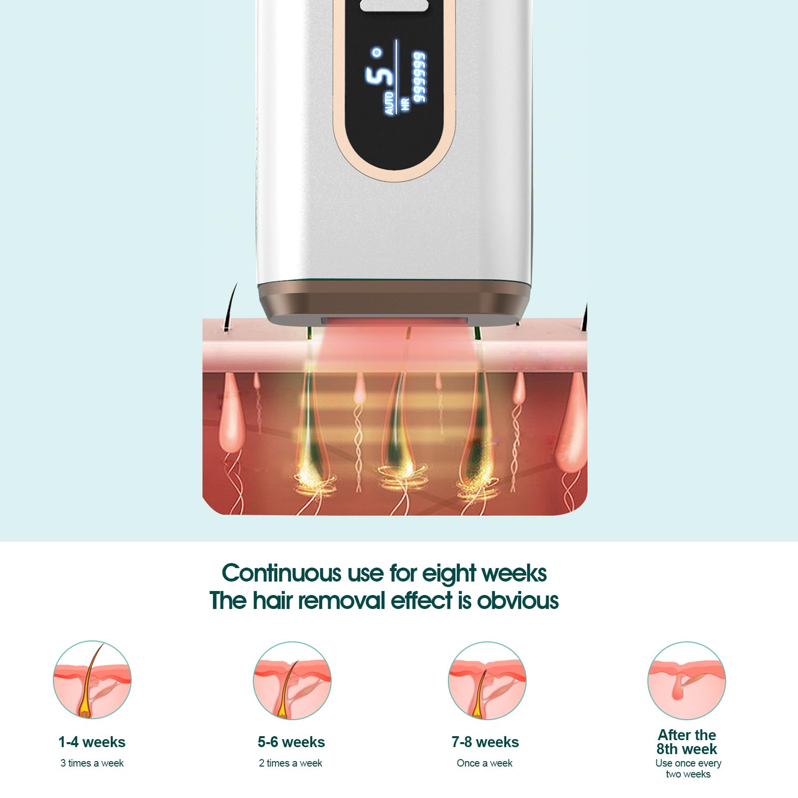 FENCY Laser Hair Removal Device for Women and Men, 5 Energy Levels and 990,000 Flashes, at-Home Permanent Painless IPL Hair Remover for Armpits Legs Facial Whole Body