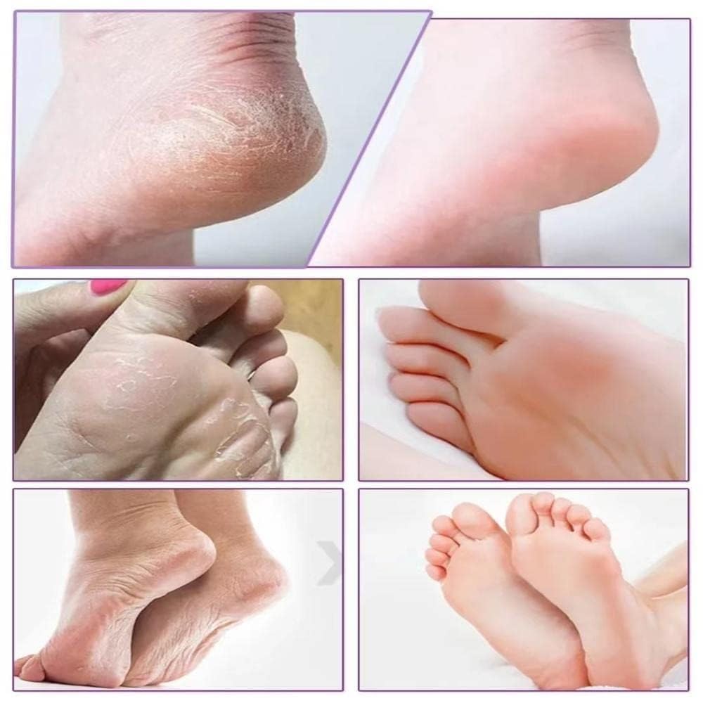 Krupasadhya Foot Peeling Mask For Dead Skin Removal, Peeling & Exfoliating Foot Mask for Dry Cracked Feet, Removes Dead Skin & Calluses, Men And Women Feet Peeling Mask Exfoliating. (Lavender) 4