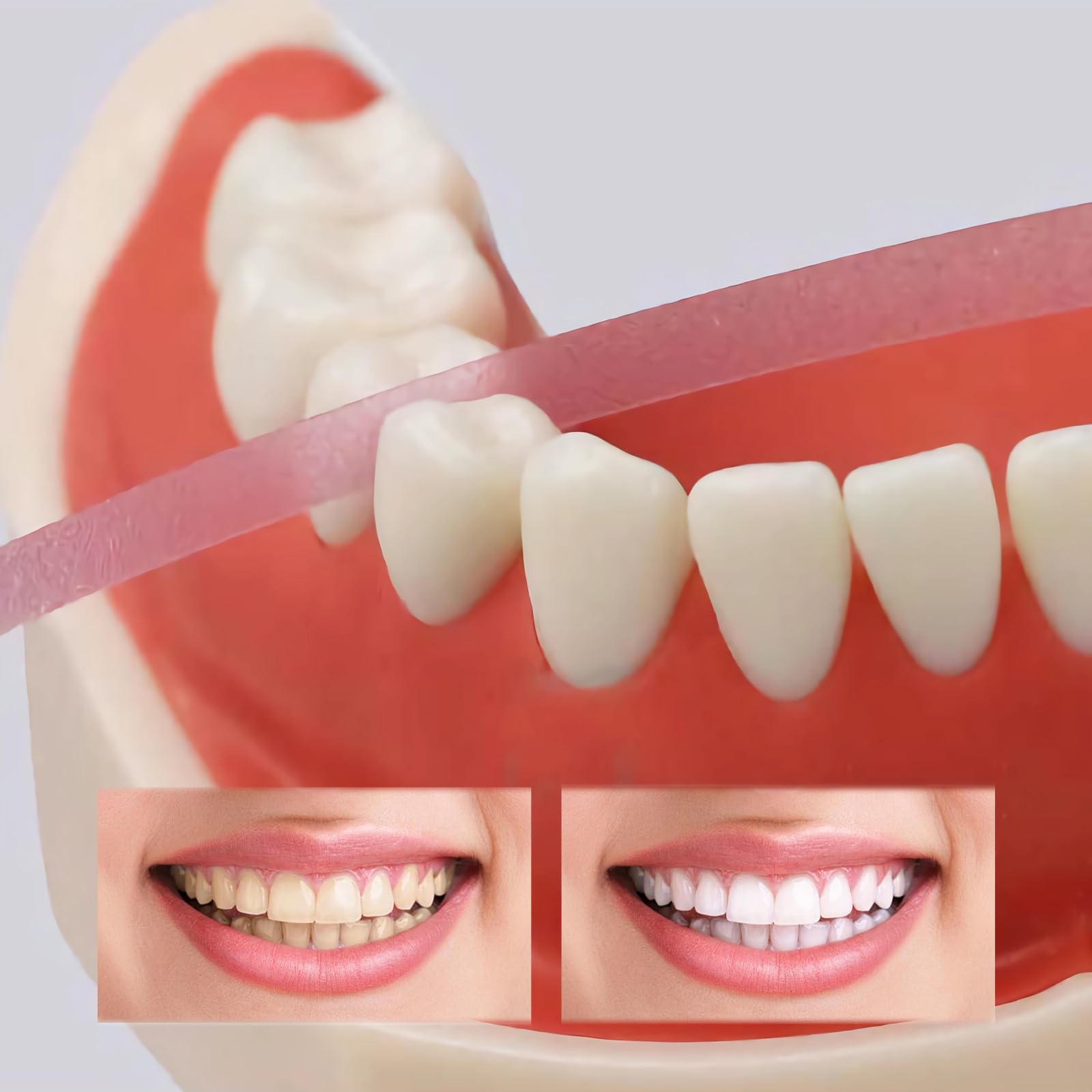 SNONESIY Papel de Lija Dental 4 mm x 6 m, Tiras de Pulido Dental para Espacios Intermedios, Eliminador de Sarro