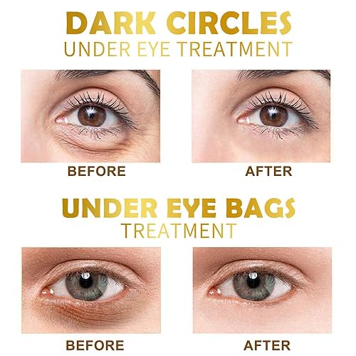 Miniatura 11 de Máscara de ojos, 30 pares de parches de colágeno debajo de los ojos, almohadillas de gel de ojos de cristal negro para reducir las ojeras, aligerar