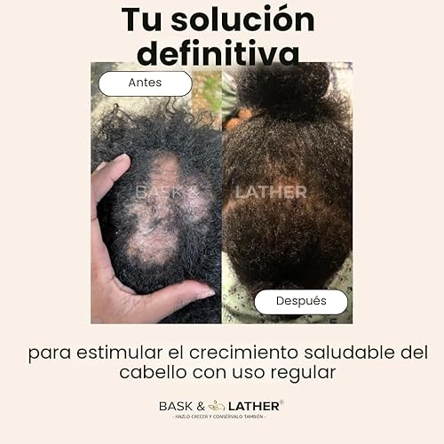 Miniatura 5 de Aceite para el crecimiento del cabello y estimulador del cuero cabelludo de Bask & Lather, mezcla de menta y romero prensada en frío con semilla