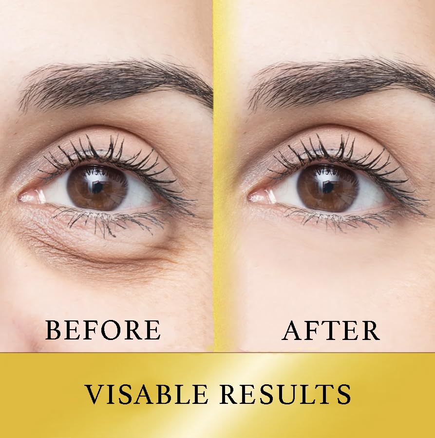 Miniatura 4 de Parches para debajo de los ojos (20 pares)  Lujosa máscara dorada para debajo de los ojos, ingredientes naturales enriquecidos, máscara debajo de