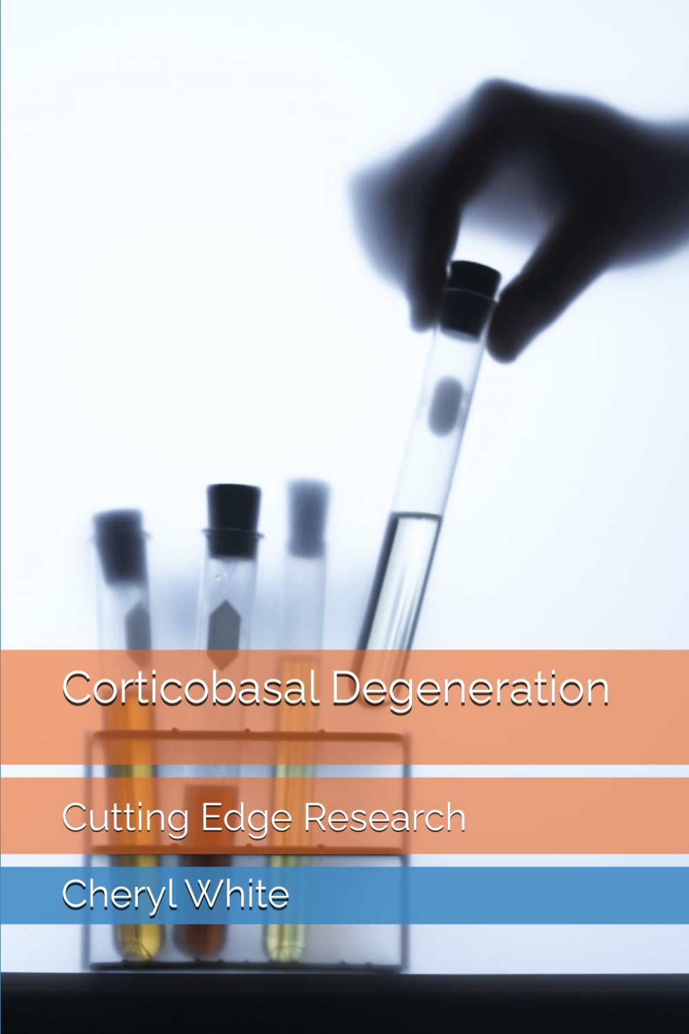 Corticobasal Degeneration: Cutting Edge Research