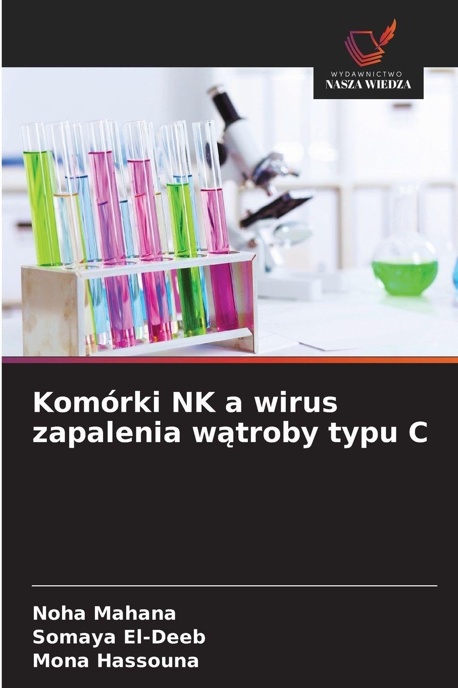 Komórki NK a wirus zapalenia w¿troby typu C