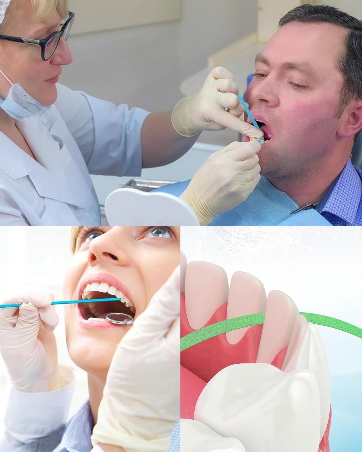 Papel de Lija Dental para Pulir Dientes Kit de Herramientas Resistente Limpieza Profunda Higiene Oral (60 Piezas)