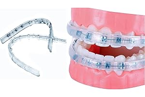 Face Braces for Teeth: Unparalleled Comfort and Protection