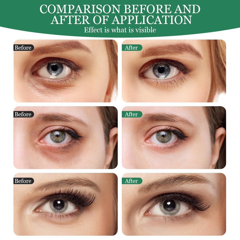 LOPHE Patch Occhi, 60 Pezzi Eye Patch Maschera Occhiaie e Borse, Collagene Patches Occhi per Rimuovi Puffiness, Idrata Anti-Età(Verde)