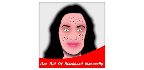 Get Rid Of Blackhead Naturally
