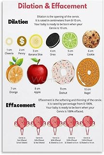 Childbirth Process Cervical Dilation Chart Handout Course Educational Poster 2 Canvas Painting Wall Art Poster for Bedroom Living Room Decor 08x12inch(20x30cm) Unframe-style
