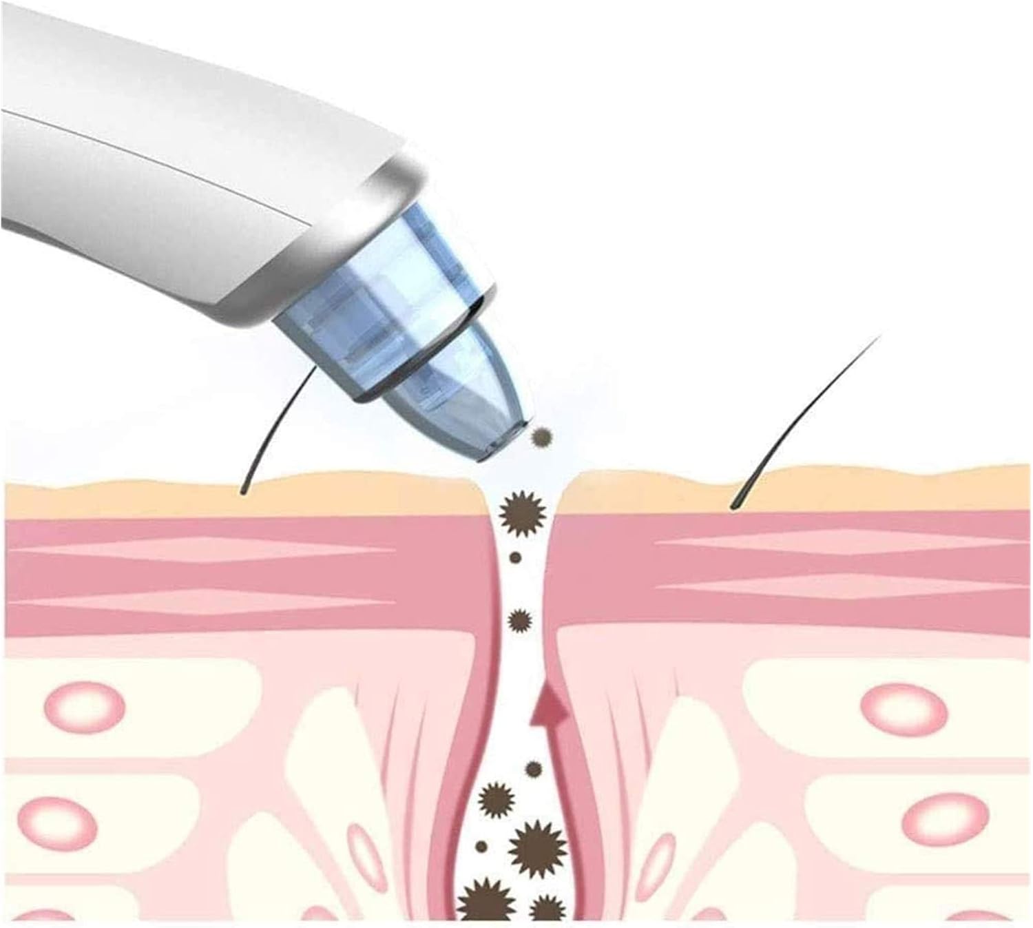 Blackhead Remover Pore - Electric Cleaner Blackhead Acne Extractor Suction Tool Hot Compress Vibration Function USB Rechargeable with 4 Suction Probes for Facial Skin