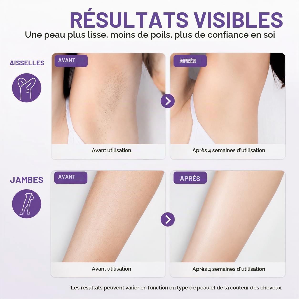 Epilateur Electrique Femme, IPL avec Controle de Temperature, Epilateur Lumiere Pulsee, Pour Visage, Aisselles Et Corps, kit Epilation Cire,Double Mode Manuel Et Automatique, Argent