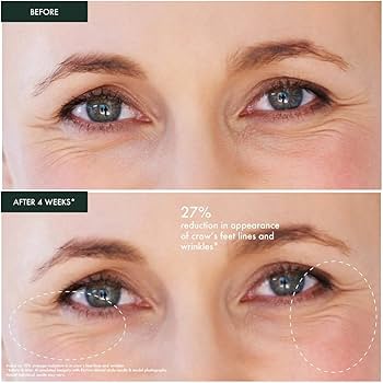 Amazon.com: RéVive Renewal Under Eye Cream - Retexturizing Eye