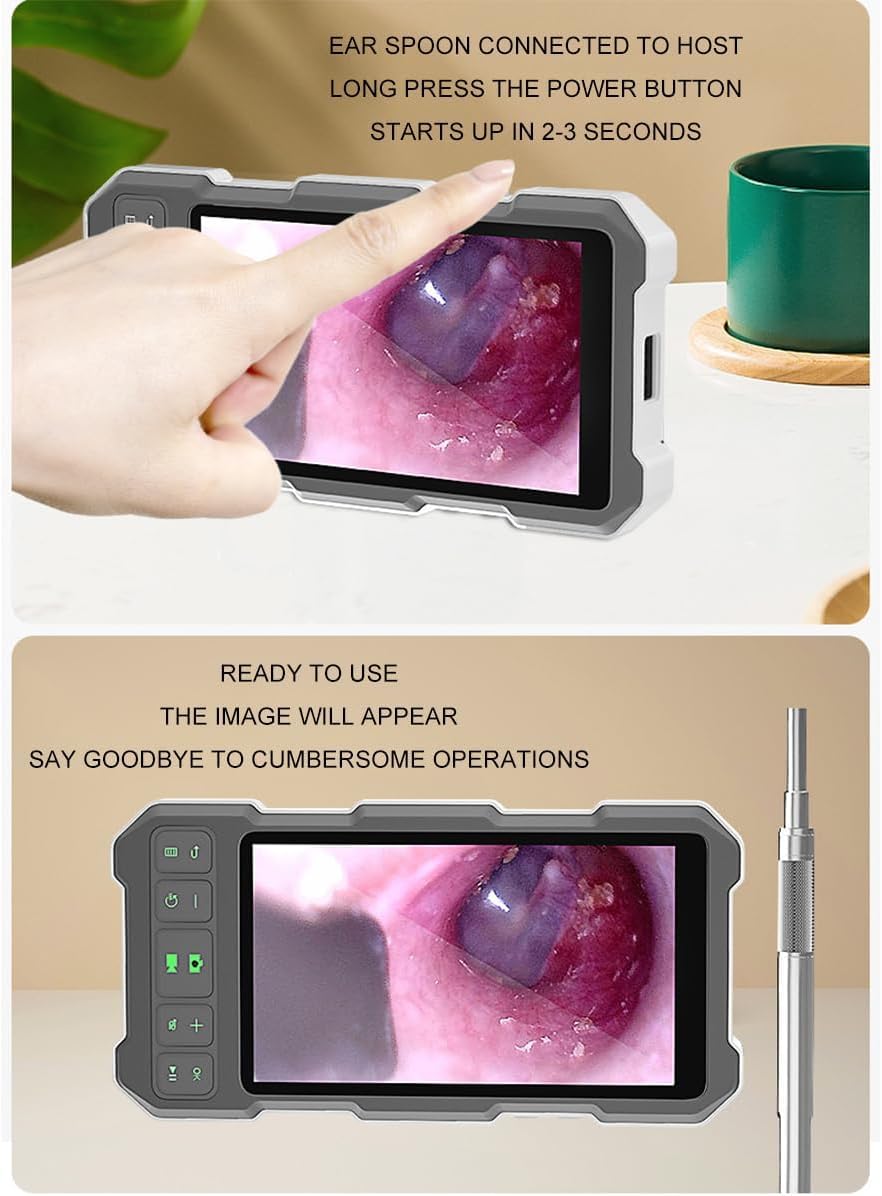 JOSBY Otoscopio Digital con Pantalla de 4,5/5 Pulgadas, Kit de cámara de eliminación de Cera para oídos con Capacidad de Memoria de 64 G, otoscopio Limpiador de oídos de 3,9 mm con 6 Luces LED
