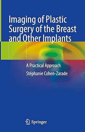 Imaging of Plastic Surgery of the Breast and Other Implants: A Practical Approach-Wow! eBook