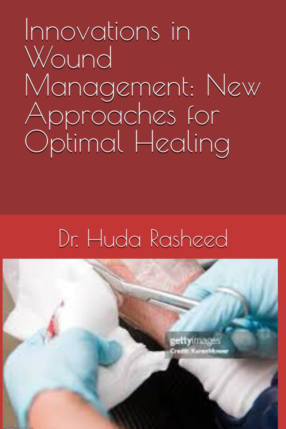Innovations in Wound Management: New Approaches for Optimal Healing