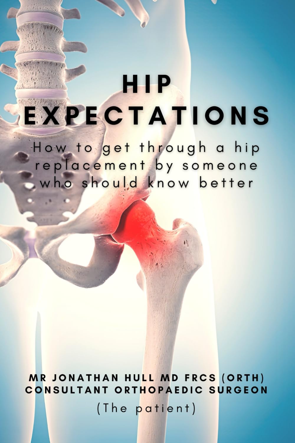 Hip Expectations: How to get through a hip replacement by someone who should know better Paperback – 18 Jan. 2022