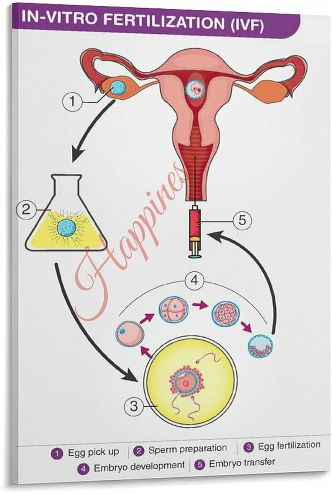 PKNVKZIDK IVF Fertilization Process Chart Poster Embryo Development Diagram Educational Canvas Wall-Art Living Room Bedroom Unframed,16x24inch(40x60cm)