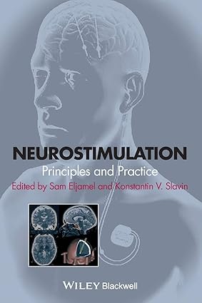 Neurostimulation Principles And Practice (Hb 2013)