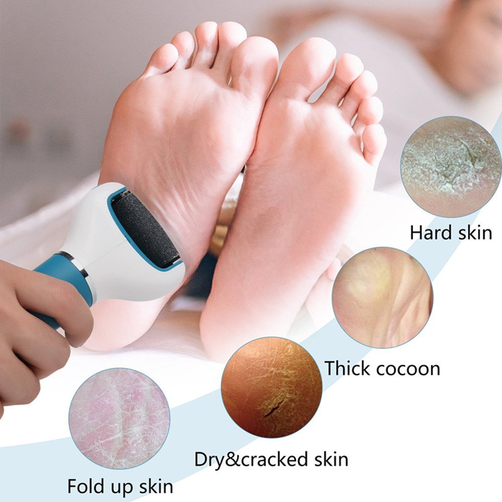 Râpe Electrique Express Soin des Pieds Usure des Pieds Réparation Broyage Exfoliation Anti-Callosités avec 2 Rouleaux de Remplacement Rechargeable USB (Style A)