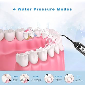 Amazon.co.jp: コードレスウォーターフロッサー 4モード
