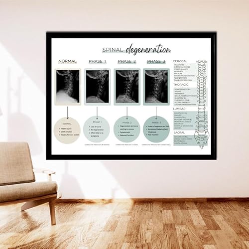 Spinal Degeneration Poster, Educational Wall Decor Spinal Degeneration, Orthopedic And
