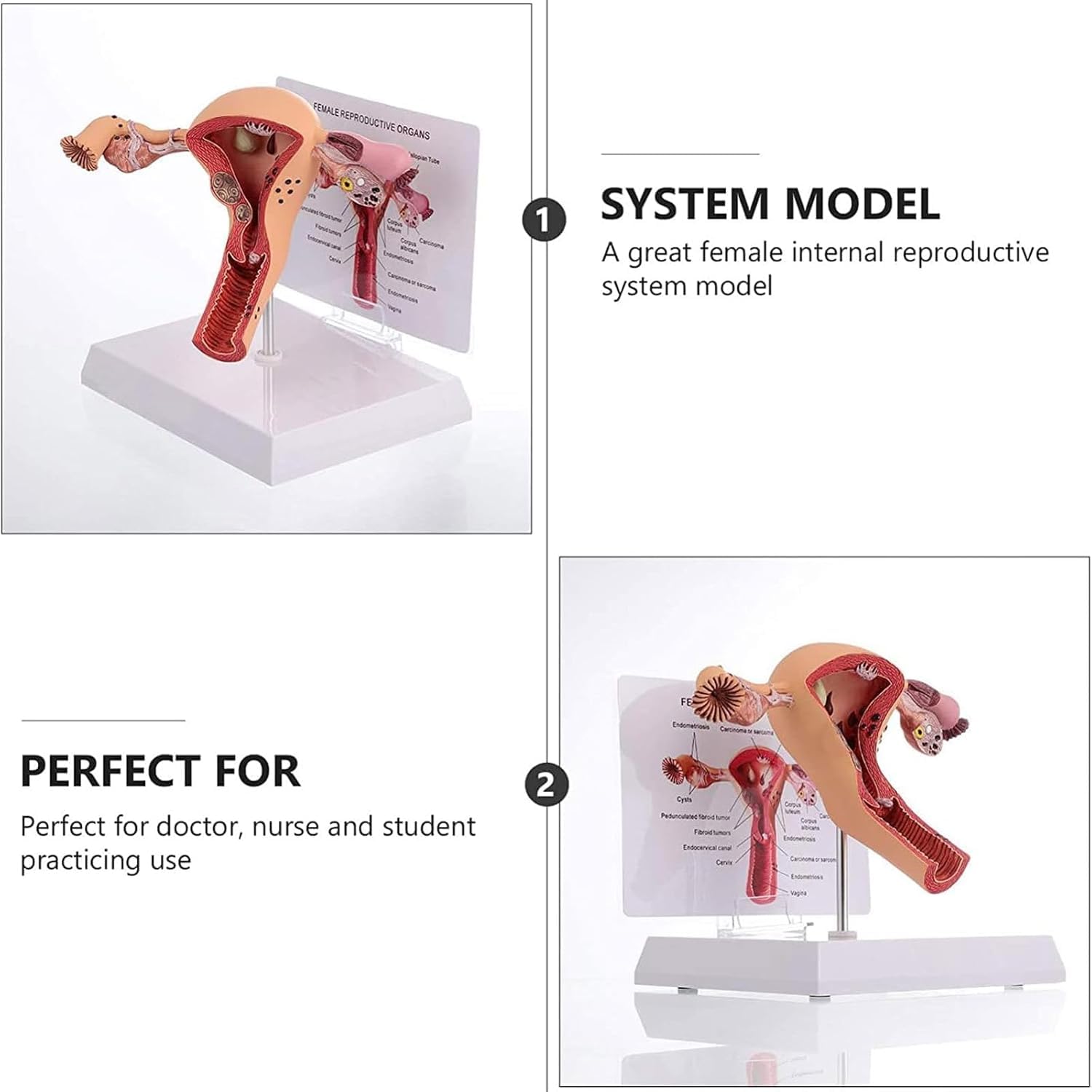 Modello del sistema riproduttivo femminile umano - Modello 3D di anatomia dell'utero e dell'ovaio per insegnamento e apprendimento, strumento educativo per studenti e professionisti sanitari