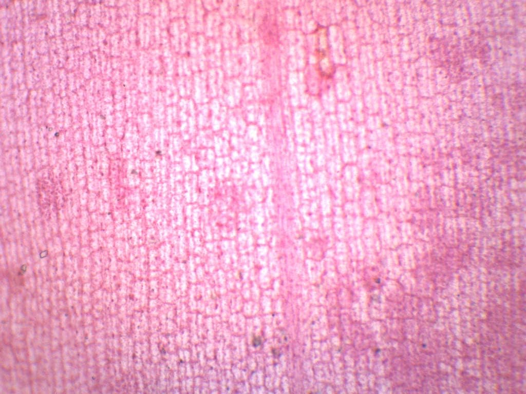 25pk Elodea, Submerged Leaf - Prepared Microscope Slides - 75 x 25mm - Classroom Pack, 25 Slides in Storage Case - Microscopy - Eisco Labs