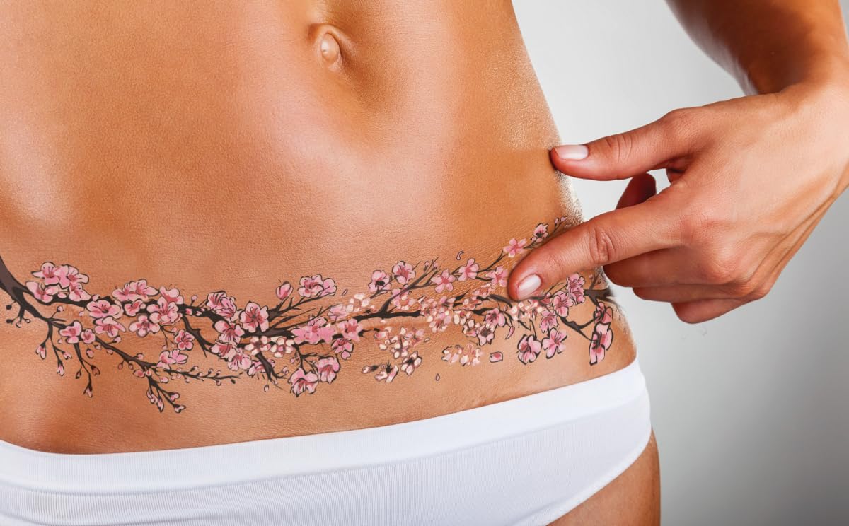 Set of 5 TuckTats: Temporary Tattoo Variety Pack- Sayura, Carpe Diem, Kennis, Black Baccara, Philenor Tattoos for Tummy Tuck, Breast Reconstruction, Mastectomy