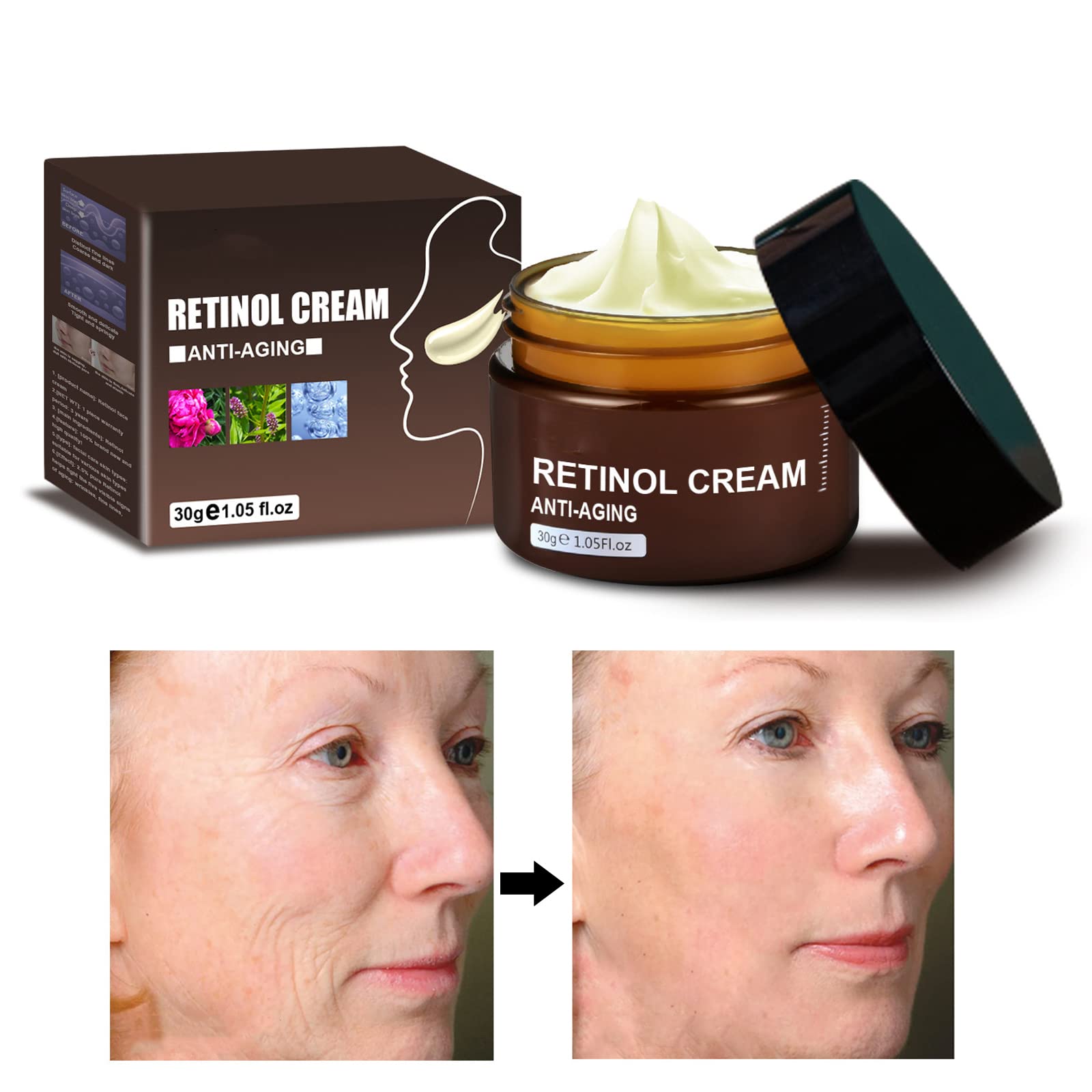 Anti-Wrinkle Face & Neck Retinol Cream with Hyaluronic Acid - Premium Anti-Aging Face Moisturizer - Anti Aging Firming Facial Cream to Reduce Wrinkles, Dark Spots, Fine Lines, Sun Damage
