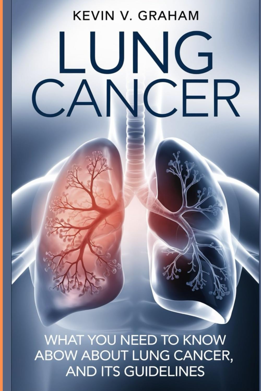 Lung cancer: What you need to Know About lung cancer, and its guidelines.