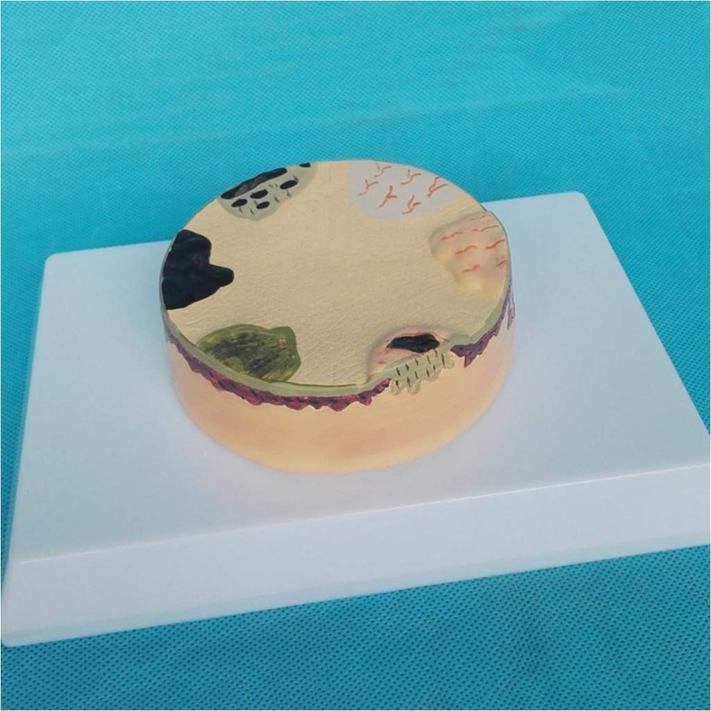 Modèle Anatomique élargi. Skin Humain - Modèle de Texture de la Peau - Modèle d'éducation - pour l'affichage enseignement modèle médical, matériel de Laboratoire