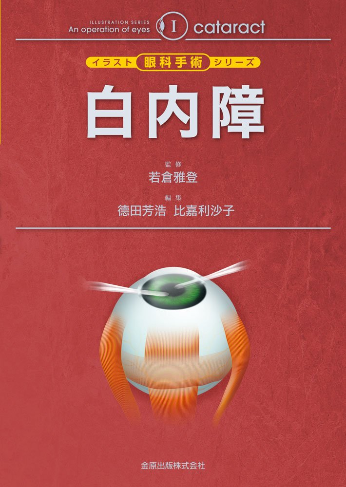 白内障 イラスト眼科手術シリーズ 雅登 若倉 芳浩 徳田 利沙子 比嘉 本 通販 Amazon