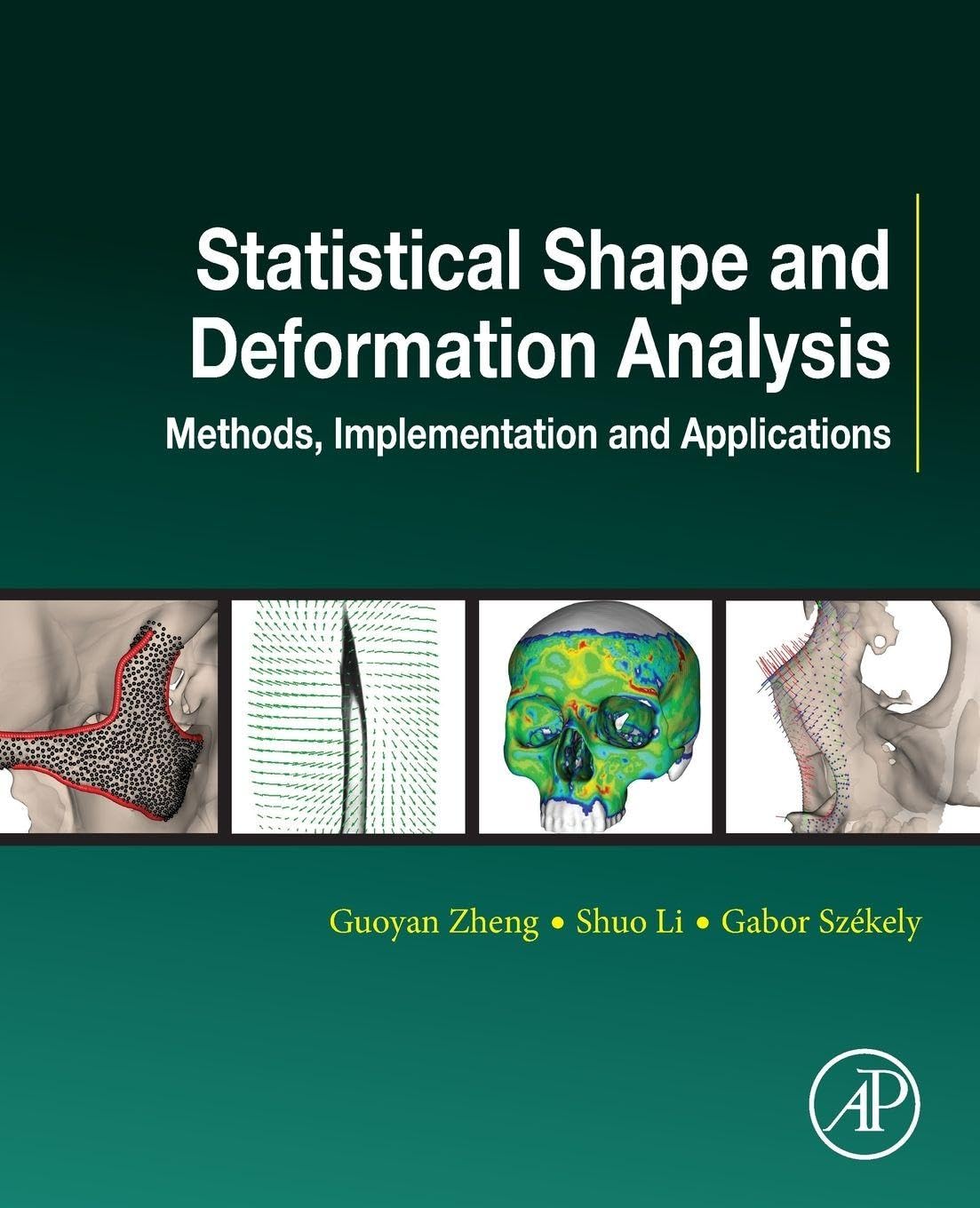 Statistical Shape and Deformation Analysis: Methods, Implementation and Applications (Computer Vision and Pattern Recognition)