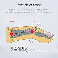 Vista 5 de 6 piezas de férula de dedo mazo de soporte de dedo férula de dedo protector de plástico para inmovilizador de dedos ajustable para protección de 6